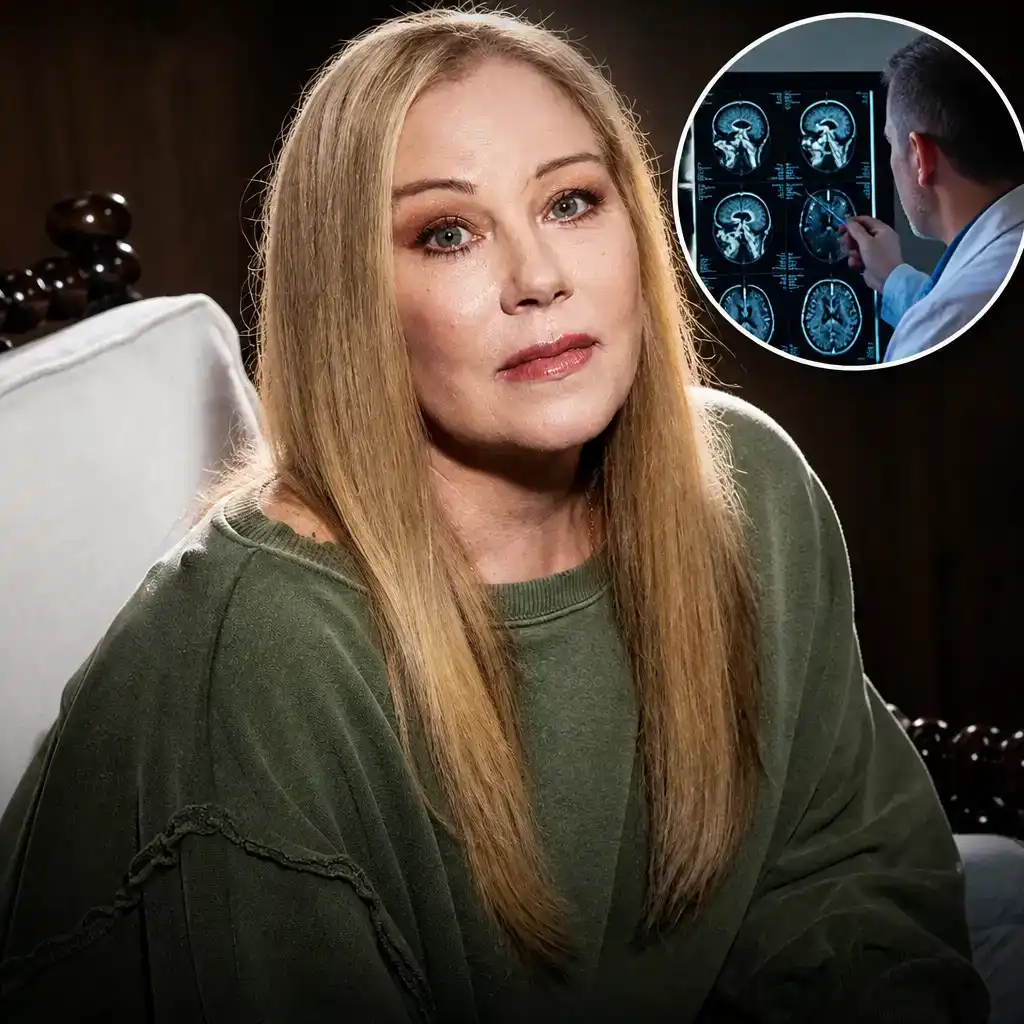 Christina Applegate Says MS Was a Misdiagnosis