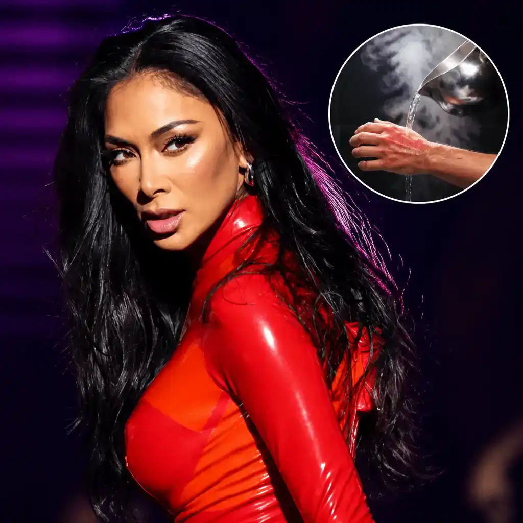 Nicole Scherzinger’s Boiling Water Burn Before Show