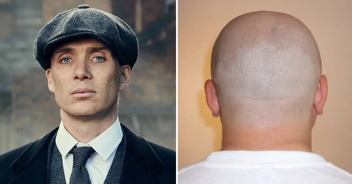Peaky Blinders Creator On The Lookout For ‘Skinheads’ In New Drama