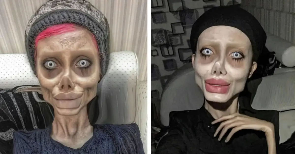 ‘Zombie’ Angelina Jolie Lookalike Showed Real Face In Interview Following Release From Prison