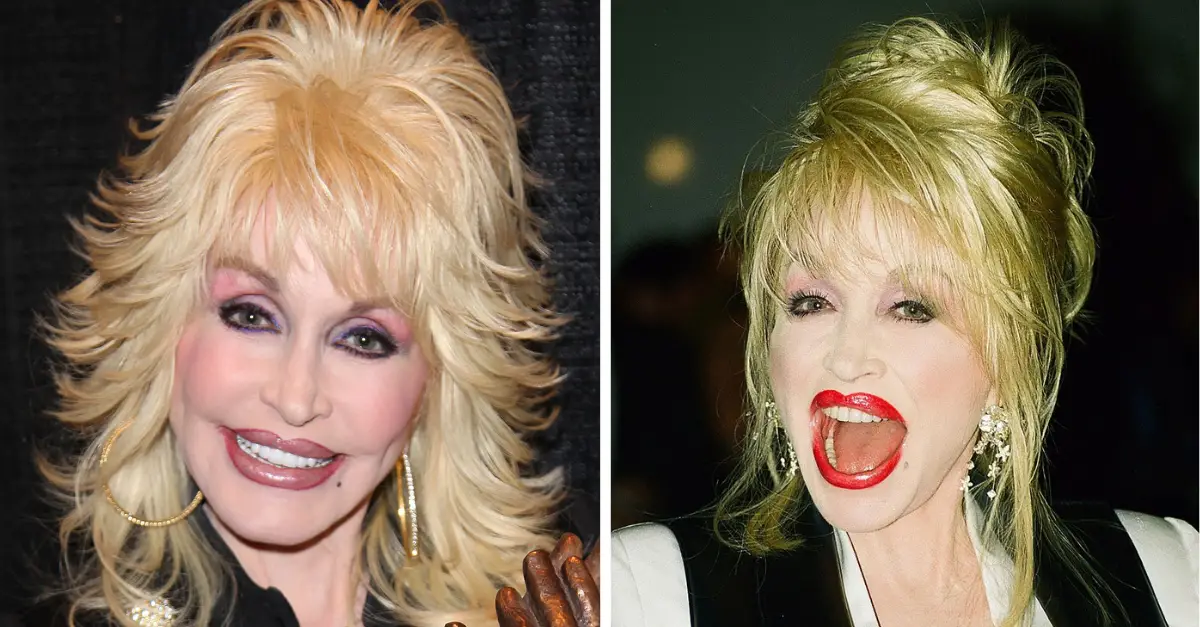 Dolly Parton Takes Off Wig And Reveals What Her Natural Hair Looks Like