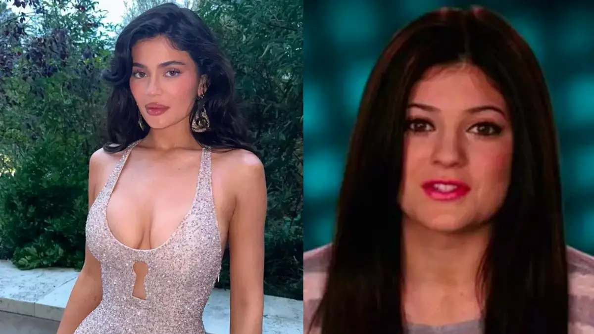 Kylie Jenner Explains Why She Looks so Different in Before and After Photos and Says it’s not Plastic Surgery