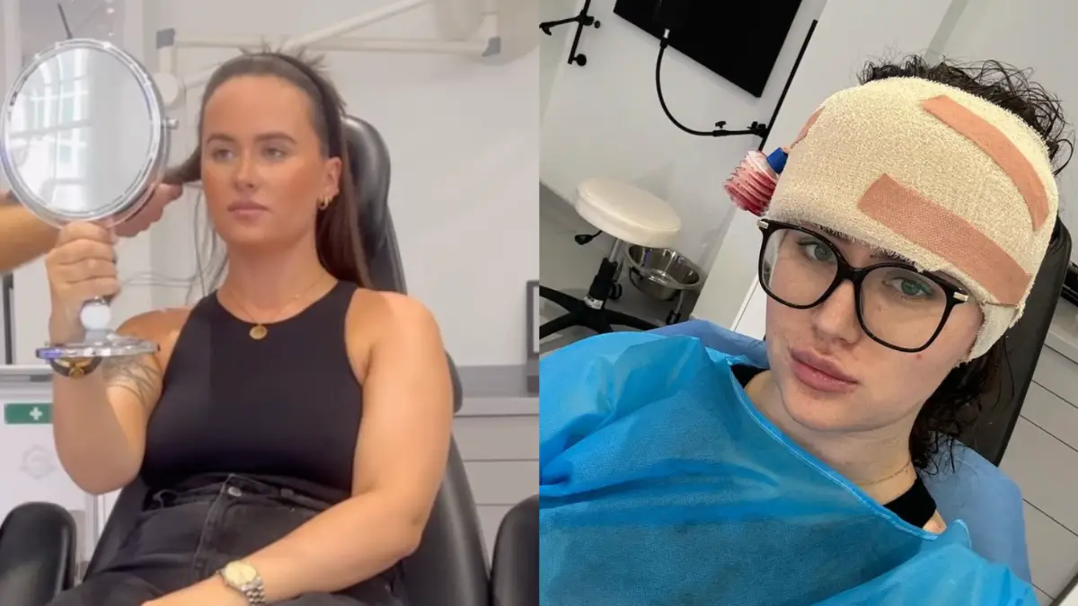 Woman Called ‘Fivehead’ By Cruel Bullies gets £9,000 Forehead Reduction Surgery