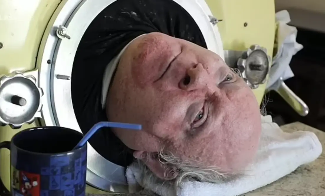 Man Dies Aged 78 After Living Inside Iron Lung For 70 Years