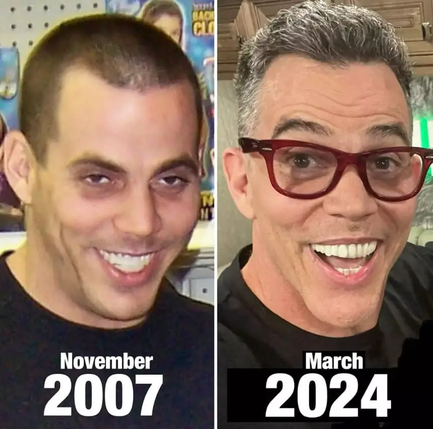 Steve-O Celebrates 16 Years of Sobriety With Shocking Before and After Photos