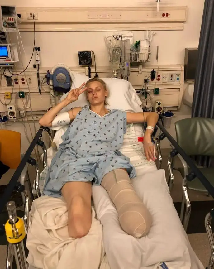 Woman Loses Both Legs and Nearly Dies Because She Used a Tampon Incorrectly