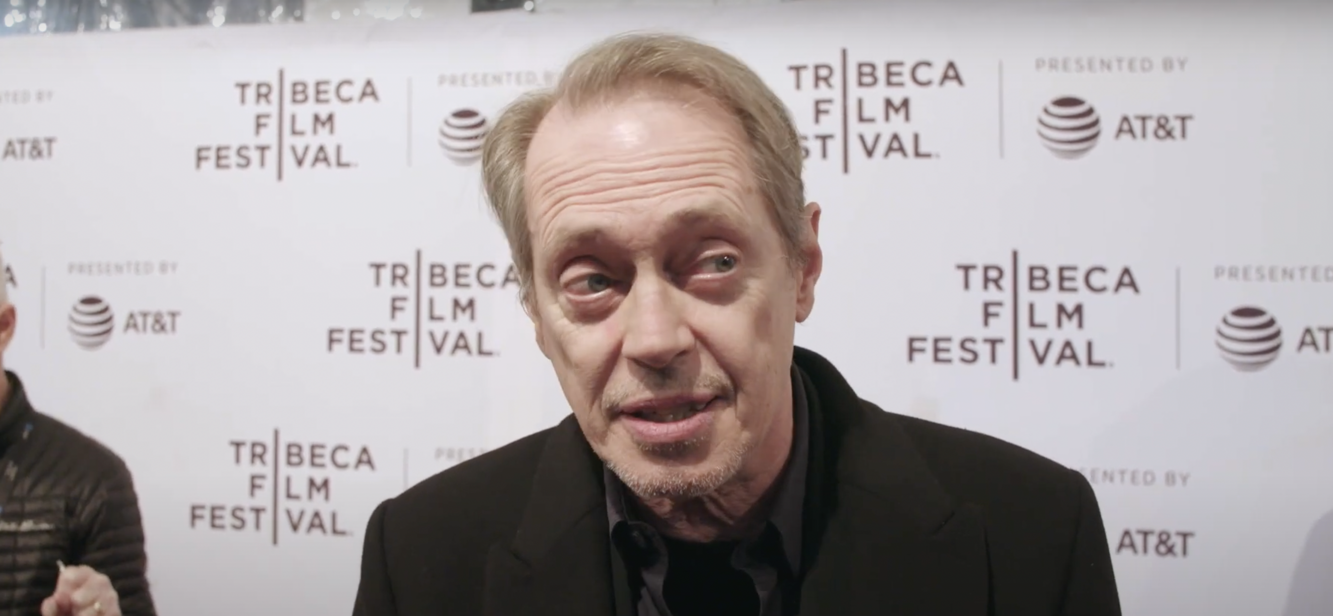 Steve Buscemi’s Gruesome Injuries Pictured After Sick Random Attack In NYC