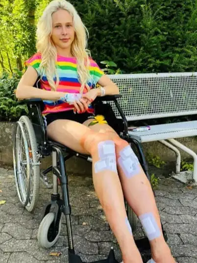 Woman Who Got $162,000 ‘Frankenstein’ Surgery To Extend Legs By 5.5 Inches Opens Up About Her Regrets