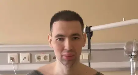 Russian ‘Popeye’ Could Lose Both His Arms After Injecting Them With Petroleum Jelly