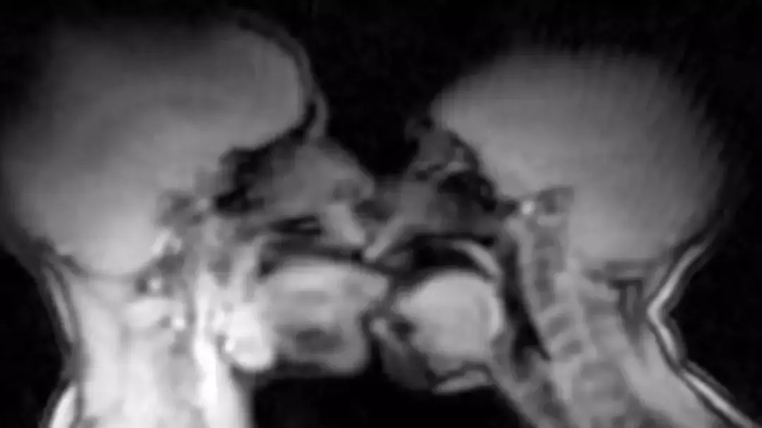 Couple Had Sex In MRI Machine To Show What Really Happens